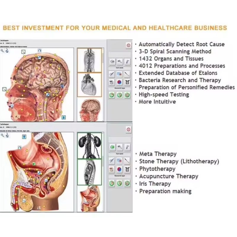 Metatron Hunter 4025 NLS Biore - Holistic Health & Wellness ulasan dan harga